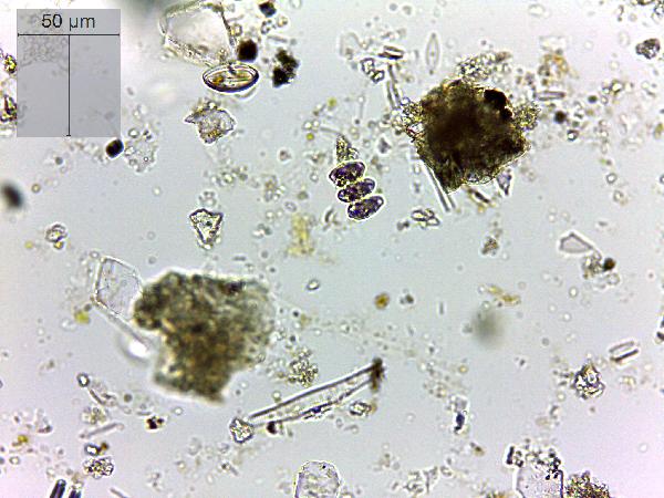 Chlorophyte (Scenedesmus sp.)