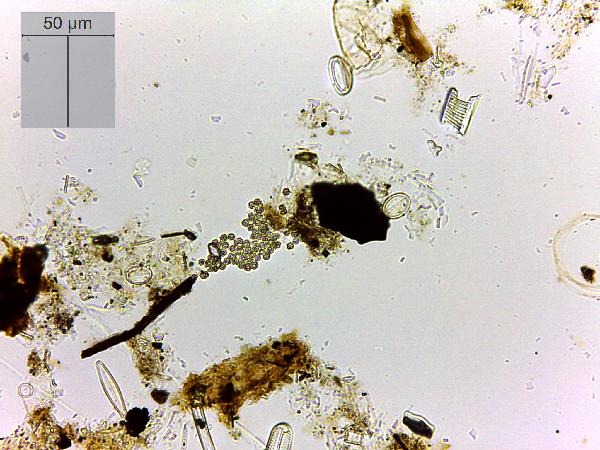 Cyanobacteria (cf. Microcystis sp.)