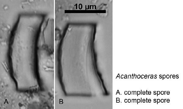 Diatom (Acanthoceras sp.)