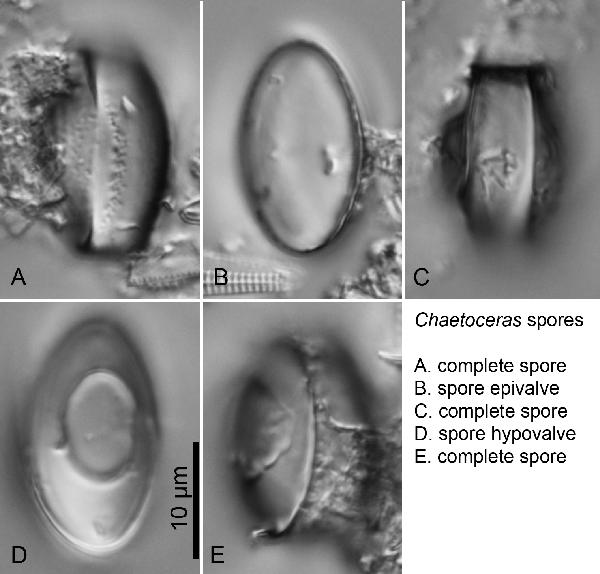 Diatom (Chaetoceras elmorei )