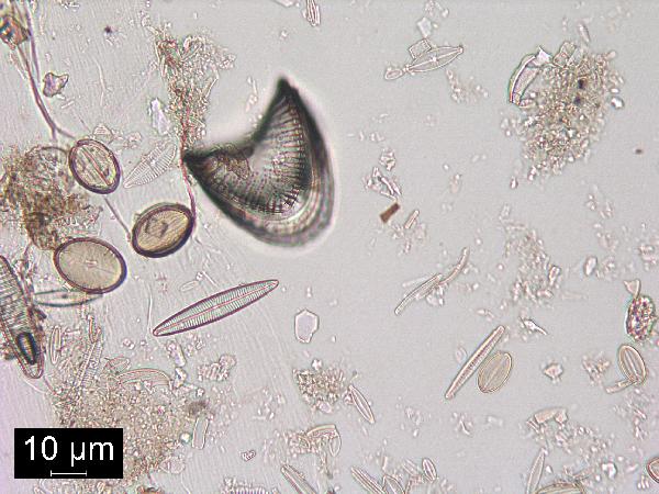 Diatom (Campylodiscus sp.)