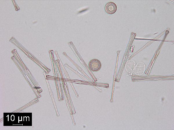 Diatom (Puncticulata lemanica)